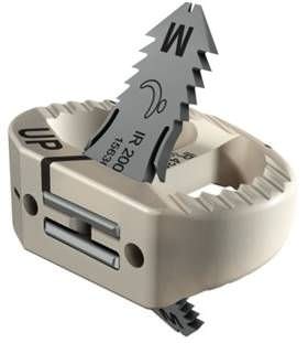 Caja intersomática lumbar - ROI-A® Oblique - LDR Medical - vía anterior / de PEEK