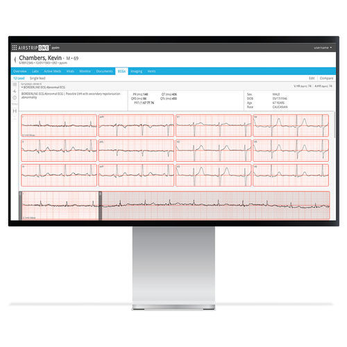 Software de gestión - AirStrip Technologies - de tratamiento / de interpretación / médico