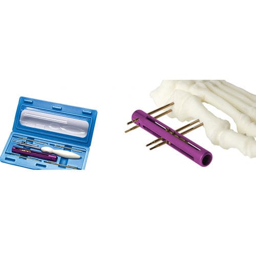 Fijador externo para tarso - SIDEKICK™ - Wright Medical Technology - tubular / para adulto