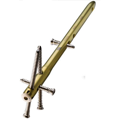 Clavo intramedular para tobillo - VALOR™ - Wright Medical Technology - fijación distal