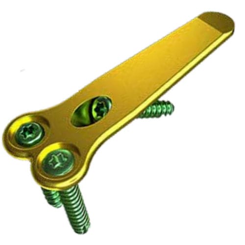 Placa de artrodesis para hallux valgus - MAXLOCK™ EXTREME™ - Wright Medical Technology - porción distal / porción proximal / bloqueada