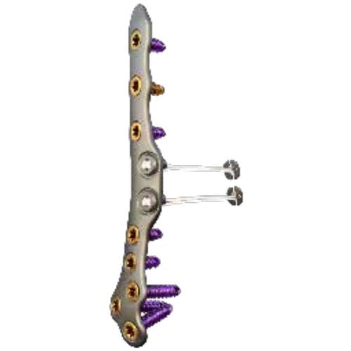 Placa de compresión para tibia - ORTHOLOC™ 2 - Wright Medical Technology - para peroné / para tobillo / porción proximal