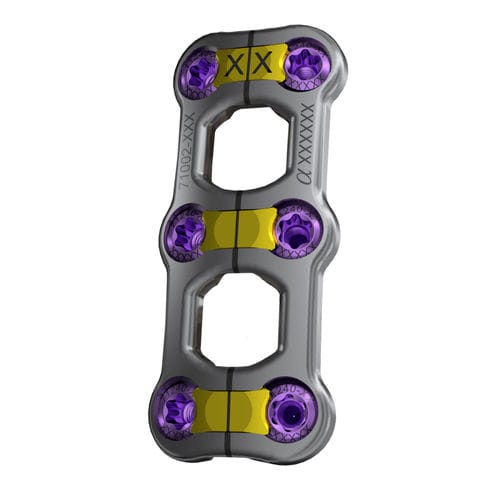 Placa de artrodesis cervical - Trestle Luxe™ - Alphatec Spine - bloqueada / 2 niveles