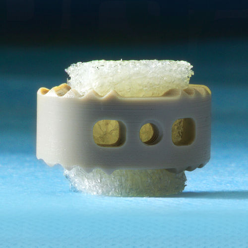 Sustituto óseo alotrasplante - 3D Profuse® - Alphatec Spine - para cirugía ortopédica / maleable