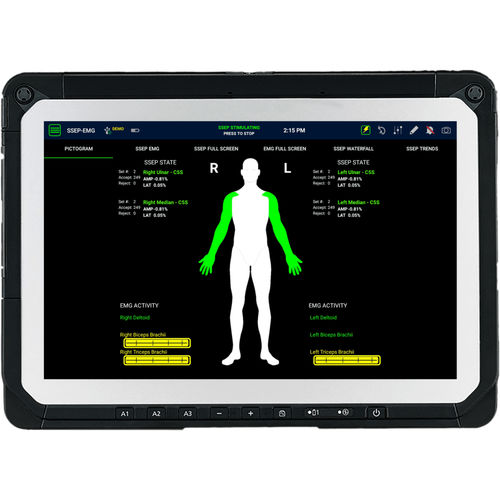 Sistema de información de monitorización - SafeOp™ - Alphatec Spine - para neurocirugía / ortodóntica