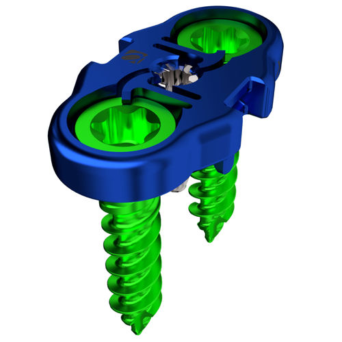 Placa de artrodesis para vértebra lumbar - AMP™ - Alphatec Spine - lateral / bloqueada