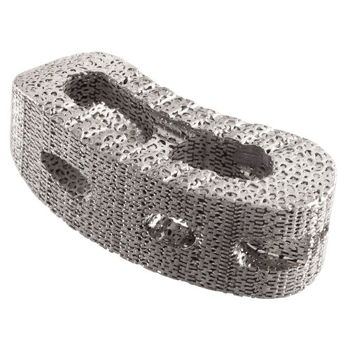 Caja intersomática toracolumbar - IdentiTi™-PC - Alphatec Spine - vía posterior / de titanio