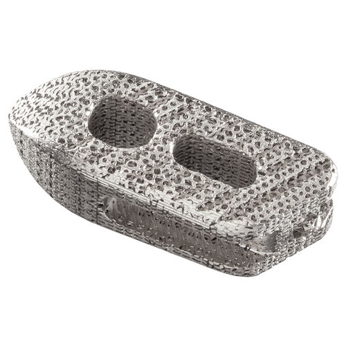 Caja intersomática toracolumbar - IdentiTi™-PO - Alphatec Spine - vía posterior / vía oblicua / de titanio