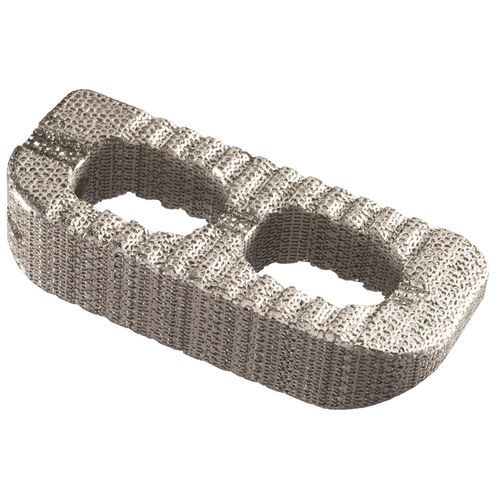 Caja intersomática torácica - IdentiTi™ LIF - Alphatec Spine - vía lateral / de titanio