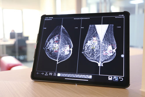 Aplicación web médica - UDE - EBM Technologies - para imágenes médicas / para DICOM / de intercambio