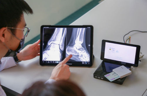 Aplicación para iOS médica - EXCD - EBM Technologies - para PACS / visualizador / servidor