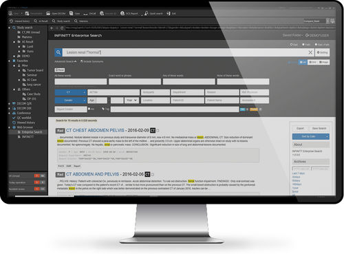 Software de gestión - Vendor - INFINITT North America - de monitorización / de intercambio / de archivo