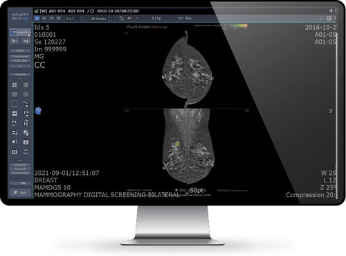 PACS para imágenes médicas - INFINITT North America