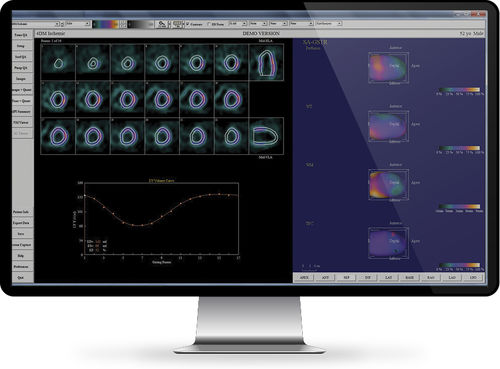 Software para informes - INFINITT North America - visualizador / de postprocesamiento / clínico