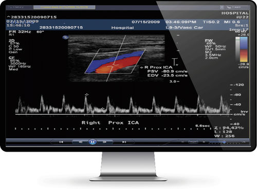 Software de gestión de datos - INFINITT North America - médico / de hospital / de cardiología