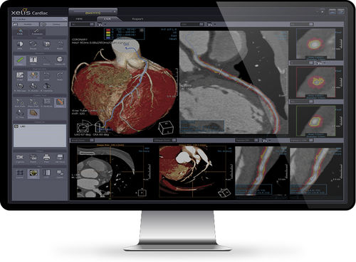 Software de análisis - Xelis™ Cardiac - INFINITT North America - de visualización 3D / de diagnóstico / de medición