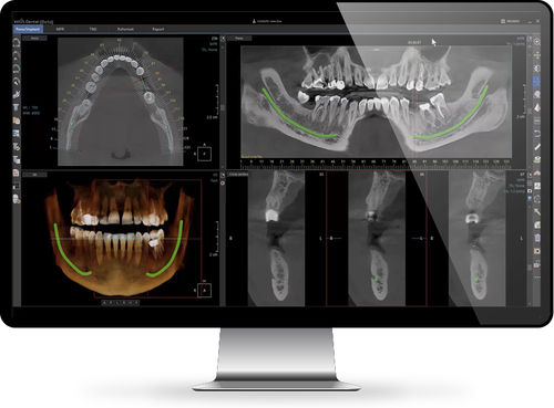 Software para informes - Xelis™   - INFINITT North America - de visualización / de diagnóstico / de planificación
