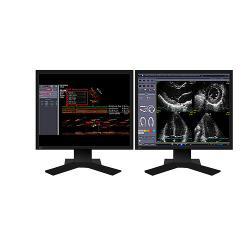 Software para ecocardiografía - INFINITT North America - para informes / de visualización / de diagnóstico