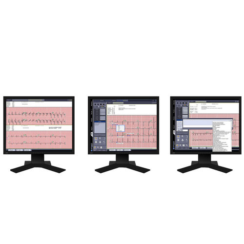 Sistema de gestión y análisis de visualización - INFINITT North America - ECG