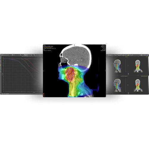Software de monitorización de dosis de radiación - MIM SureCalc® MonteCarlo - MIM Software - de medición / de planificación / de tratamiento