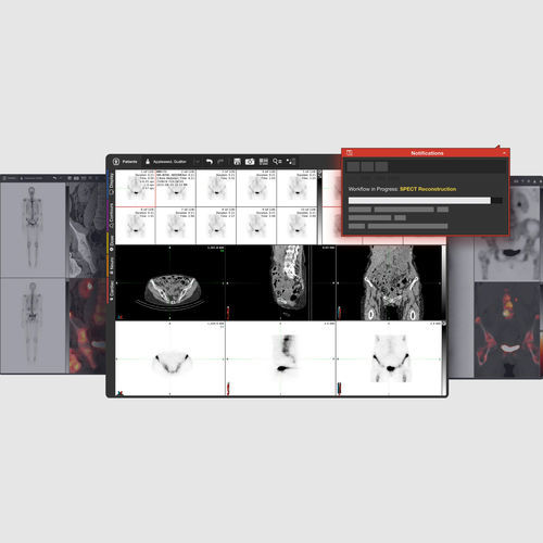 Software de análisis - MIM Encore® - MIM Software - de visualización / de diagnóstico / TEP