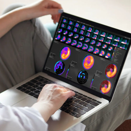 Software clínico - MIMcardiac® - MIM Software - TDM / TEP / SPECT