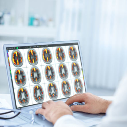 Software para imagen cerebral - MIMneuro® - MIM Software - de análisis / de visualización 3D / de diagnóstico