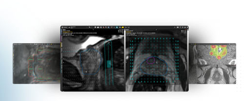 Software de visualización 3D - MIM Symphony LDR™ - MIM Software - de adquisición / de planificación / de planificación de tratamiento
