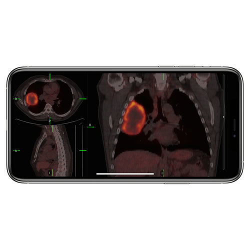 Aplicación para iOS de control de acceso - VueMe™ - MIM Software - de importación / para imágenes médicas / iOS