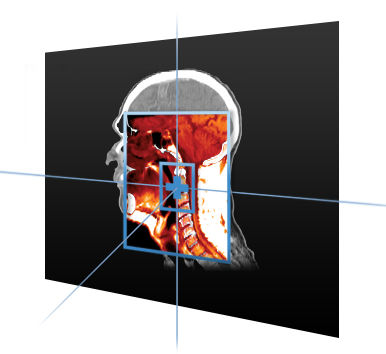 Software médico - MIM Maestro® - MIM Software - para radioterapia / de visualización / de planificación