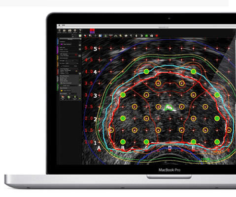 Software de análisis - MIM Symphony Dx™ - MIM Software - de gestión / para informes / de visualización