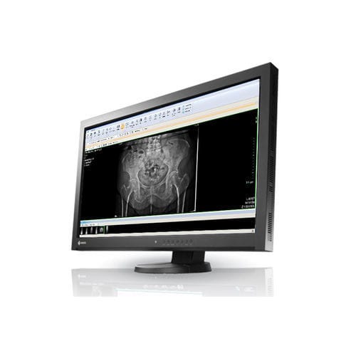 Estación de trabajo informática de diagnóstico - IDETEC MEDICAL IMAGING - de radiología