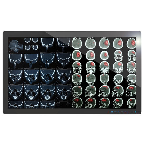 Monitor médico - 4K2K - Richardson Electronics - Healthcare - Full HD / 4K / 32"