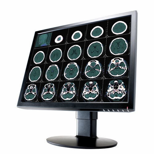 Monitor médico - 2 MP | CL2000 - Richardson Electronics - Healthcare - de diagnóstico / de radiología / 20.1"