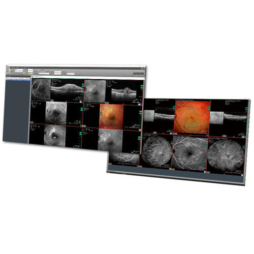 PACS médico - HEYEX  - Heidelberg Engineering