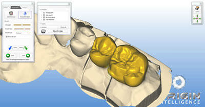 Software de creación de prótesis dentales - ORIGIN HD - B&D Dental Technologies - de CAD / FAO
