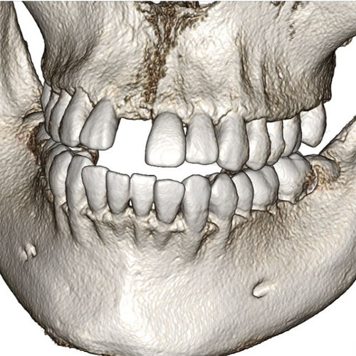 Software para odontología -  Invivo6 - Anatomage - de análisis / de visualización 3D / de diagnóstico