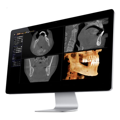 Software de visualización 3D - Invivo - Anatomage - de medición / de intercambio / médico