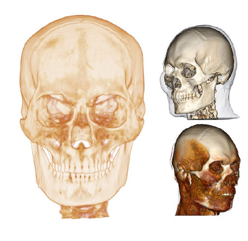 Software de visualización 3D - Medical Design Studio - Anatomage - de diseño / para la importación de imágenes médicas / de simulación en 3D