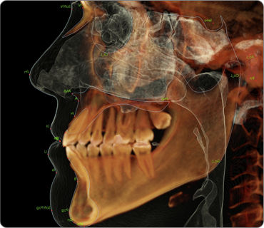 Módulo de software de análisis cefalométrico - Anatomage - de simulación en 3D / para imagen dental / ortodóntico