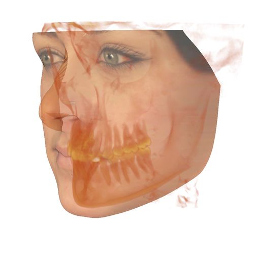 Software de visualización - Anatomodel - Anatomage - de diagnóstico / de planificación / de simulación en 3D