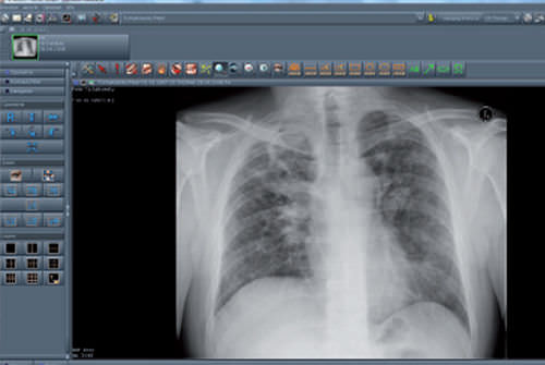Software de visualización - NEXUS / PACS - Nexus AG - para PACS / médico / de hospital