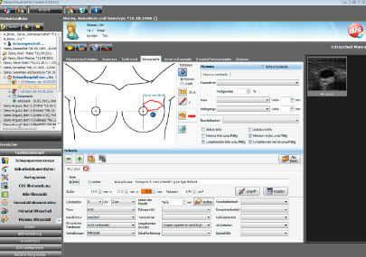 Software de gestión - NEXUS / OBSTETRICS - Nexus AG - para exploraciones ginecológicas / para exploraciones obstétricas