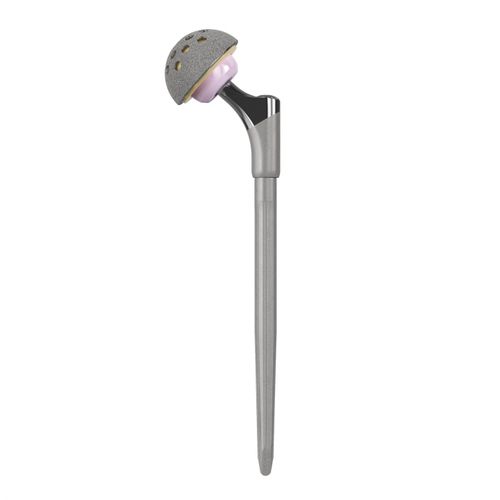 Prótesis de cadera de revisión - EXPRT® - Trilliant Surgical - no cementada