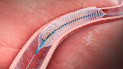 Stent arteria coronaria - DESolve™ - Elixir Medical - de PLLA / biorreabsorbible