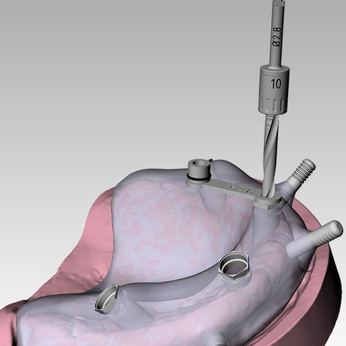 Software clínico - RealGUIDE™ - 3DIEMME - para cirugía dental / para cirugía guiada / universal