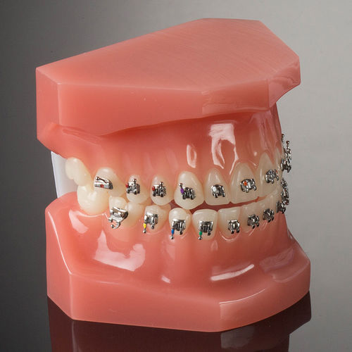 Bracket de metal - miniPrevail® - G&H Orthodontics - twins / mini