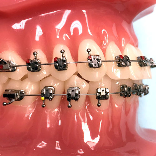 Bracket de metal Agility® G&H Orthodontics autoligante