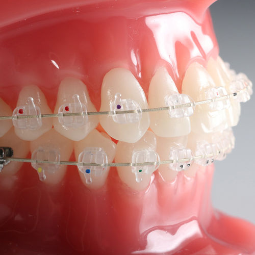 Bracket estético Vapor™ G&H Orthodontics de cerámica / transparente