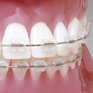 Bracket estético - Prism™ - G&H Orthodontics - transparente